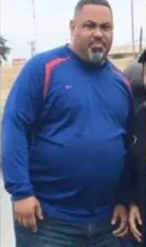 Aaron before gastric sleeve