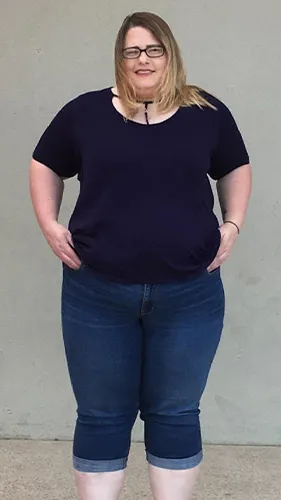 Amber before gastric sleeve
