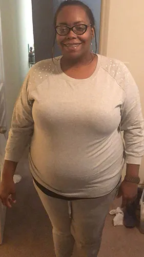 Arian before gastric sleeve