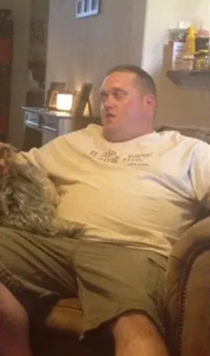 Christopher before gastric sleeve
