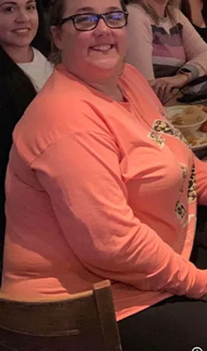 Gayla before gastric sleeve