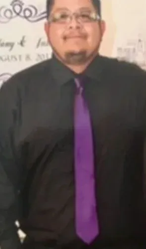 Gilbert before gastric sleeve