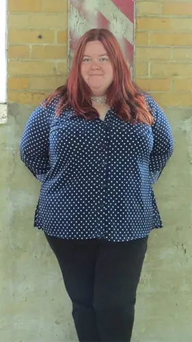 Hannah before gastric bypass