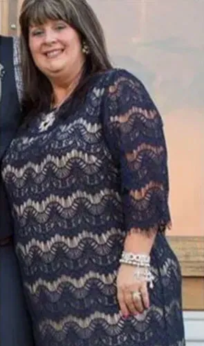 Hayli before gastric sleeve