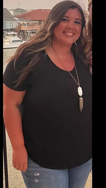 Jennifer before surgery