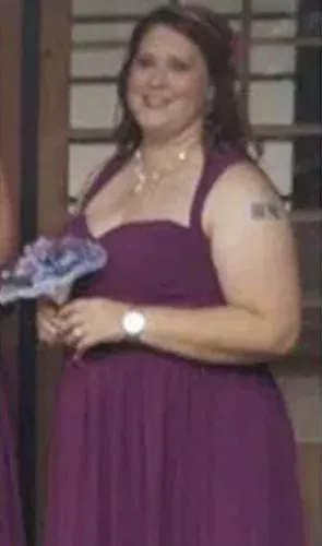 Loree before gastric sleeve