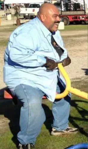 Ralph before gastric sleeve