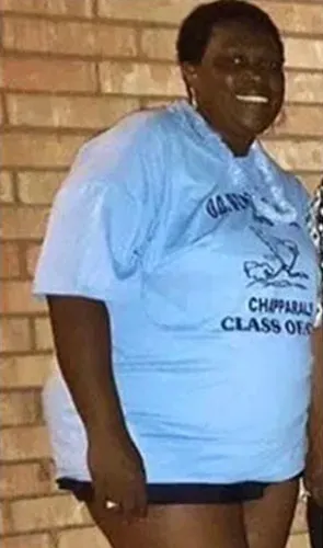 Sharon before gastric sleeve