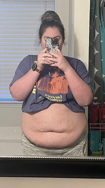 Stephanie before gastric bypass