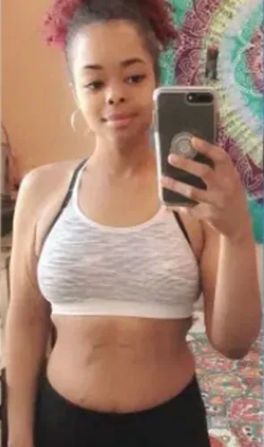 Tay after losing 122 pounds