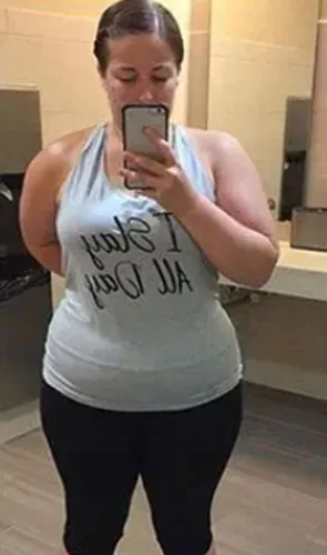 Whitney before gastric sleeve