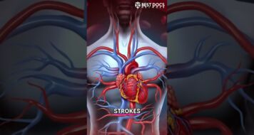 ACE Inhibitors: A Powerful Medication for Blood Pressure, Heart Health, and Kidney Protection