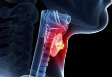 Strep Throat vs. Viral Sore Throat: How to Tell the Difference